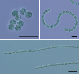 シアノバクテリアの写真