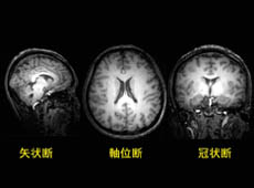 �}�P�D�]�̂R�����`�ԉ摜����؂�o�����C�R�����̒f��