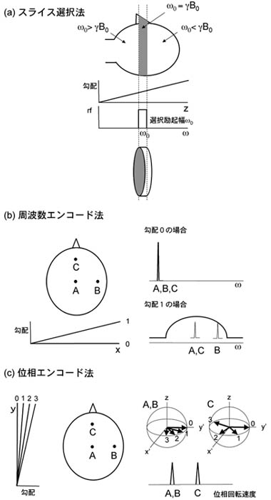 �}�P�DMRI�ŉ摜�������錴����3�v�f�������B