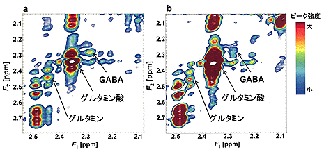 �}�R�@�J���������@�Ŏ擾�����]��ӕ������̃X�y�N�g���ia�j�ƃq�g�]�X�y�N�g��
