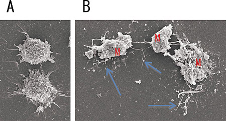 �}�R�@(A)���C�ȃ}�N���t�@�[�W�A(B)���w�J�[�{���i�m�`���[�u(��)�̔��I�ɂ���Ď��񂾃}�N���t�@�[�W(M)