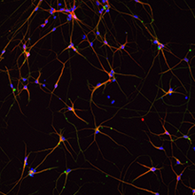 神経細胞・グリア細胞と共焦点レーザー顕微鏡の写真