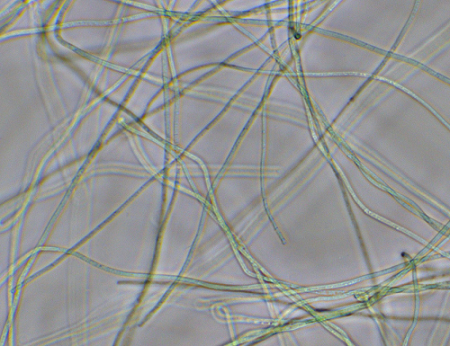 アンナミアは多数の細胞が連結した細長い糸状であるという写真