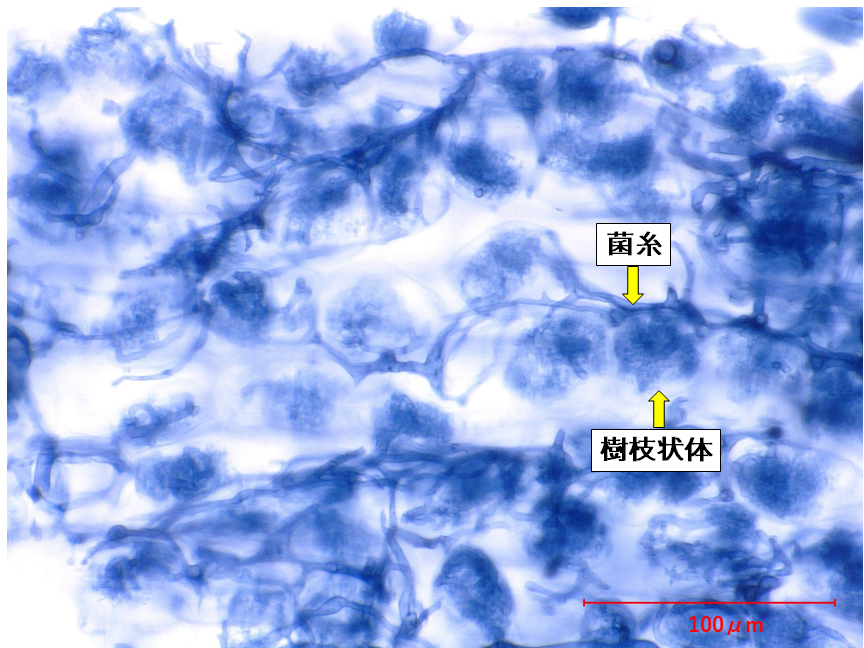 写真2　オヒルギの根内から見つかったアーバスキュラー菌根菌．菌糸や樹枝状体（植物と菌根菌が養分を交換する場所）等の器官が見られる．