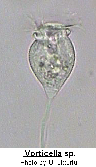Vorticella Morphology