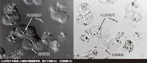 火山灰粒子を貪食した細胞の顕微鏡写真。微分干渉像(左)　位相差像(右)