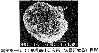 スギ花粉の写真。高橋裕一氏（山形県衛生研究所；客員研究員）撮影