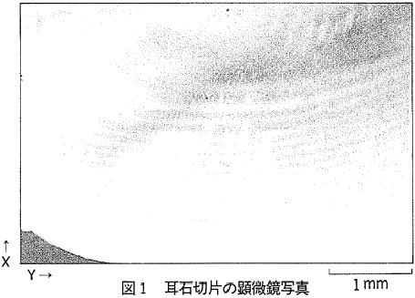 図1 耳石切片の顕微鏡写真