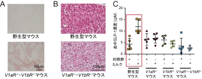 バソプレシン受容体遺伝子欠損マウスの骨格筋および褐色脂肪組織の形態と血中GLP-1濃度の図