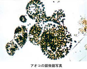 アオコの顕微鏡写真
