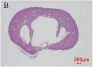 「B授乳期ダイオキシン曝露マウスで見られた水腎症」の写真