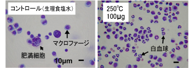 「生理食塩水と250℃熱処理クロシドライト100μgをマウスの腹腔内に投与して24時間後の腹腔内の細胞像」の写真