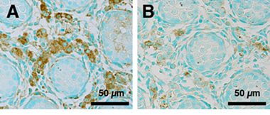 「胎仔ラットの精巣における3β-HSDの免疫染色組織像」のA,B写真