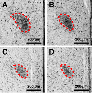 「カルビンディンD28Kの免疫染色により検出した成熟ラットのSDN-POA」のA,B,C,D写真