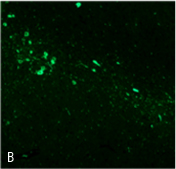 「ドーパミン合成酵素の免疫組織染色像：Bドーパミン神経細胞が脱落の様子」の写真