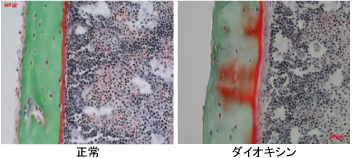 「正常マウスの骨（左）とダイオキシンに曝露したマウスの骨（右）」の写真