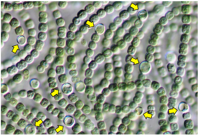 シアノバクテリアの顕微鏡写真（Nodularia sp. NIES-3585）